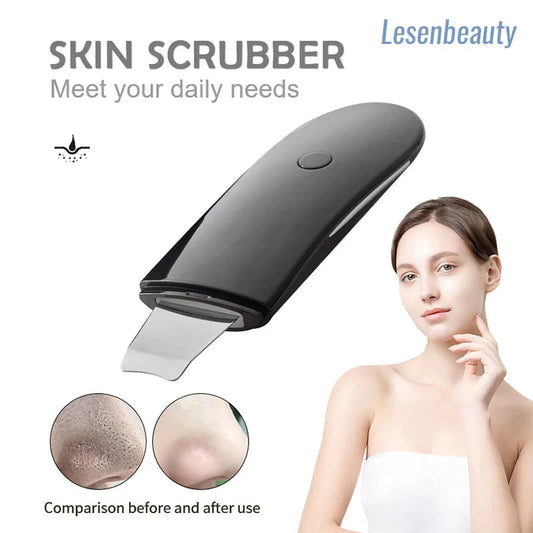 Ultrasonic Facial Cleansing Brush FitiqueFit