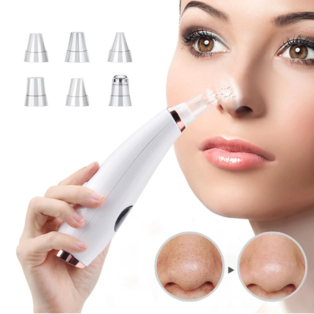 Electric Blackhead Remover Vacuum Acne Cleaner Black Spots Removal Facial Deep Cleansing Pore Cleaner Machine Skin Care Tools DermaStorm