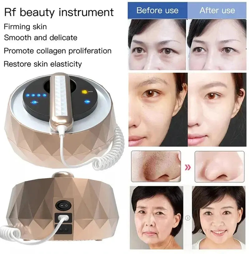 3 in 1 RF Radio Frequency Beauty Machine Facial And Body Radiofrequency Anti Aging Skin Care RF Skin Tightening Lifting machine  FitiqueFit