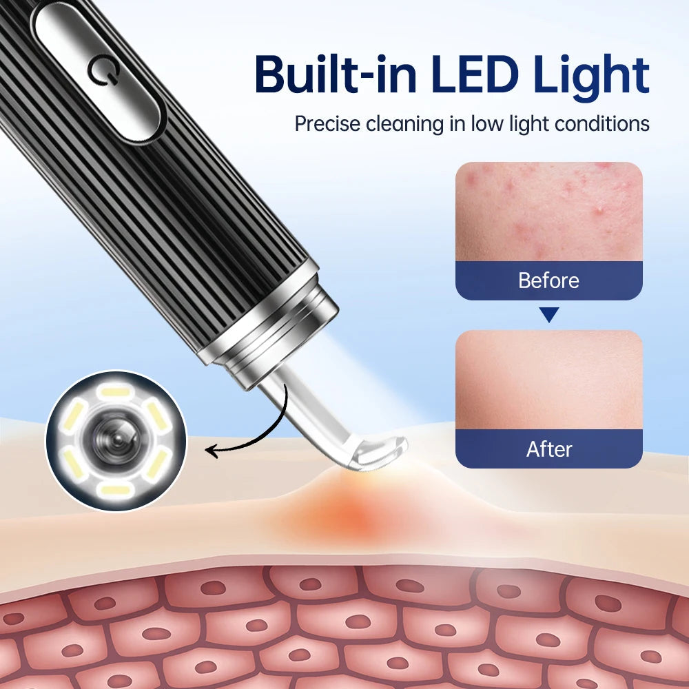 Visual Blackhead Remover with Camera Pimple Popper Extractor Tool Pore Cleaner Kit for Acne Comedone Whitehead Black Dots Remove  FitiqueFit