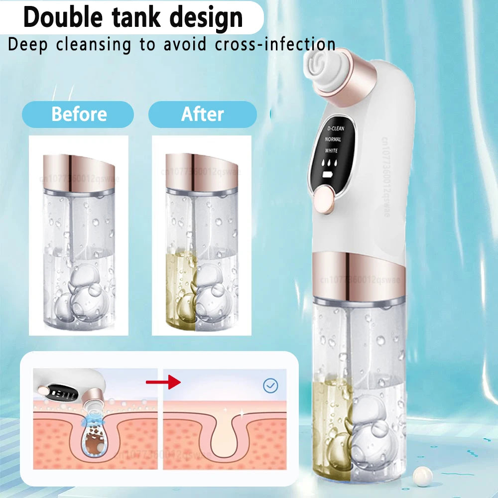 Blackhead Remover Pore Vacuum Face Cleaner Electric Pimple Acne Black Head Removal USB Rechargeable Water Cycle Black Dot Remove DermaStorm