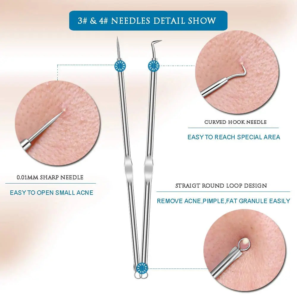 Dighealth 4PCS Stainless Steel Blackhead Remover Extraction Pimple Comedone Acne Extractor Whitehead Blemish Popper Kit  FitiqueFit