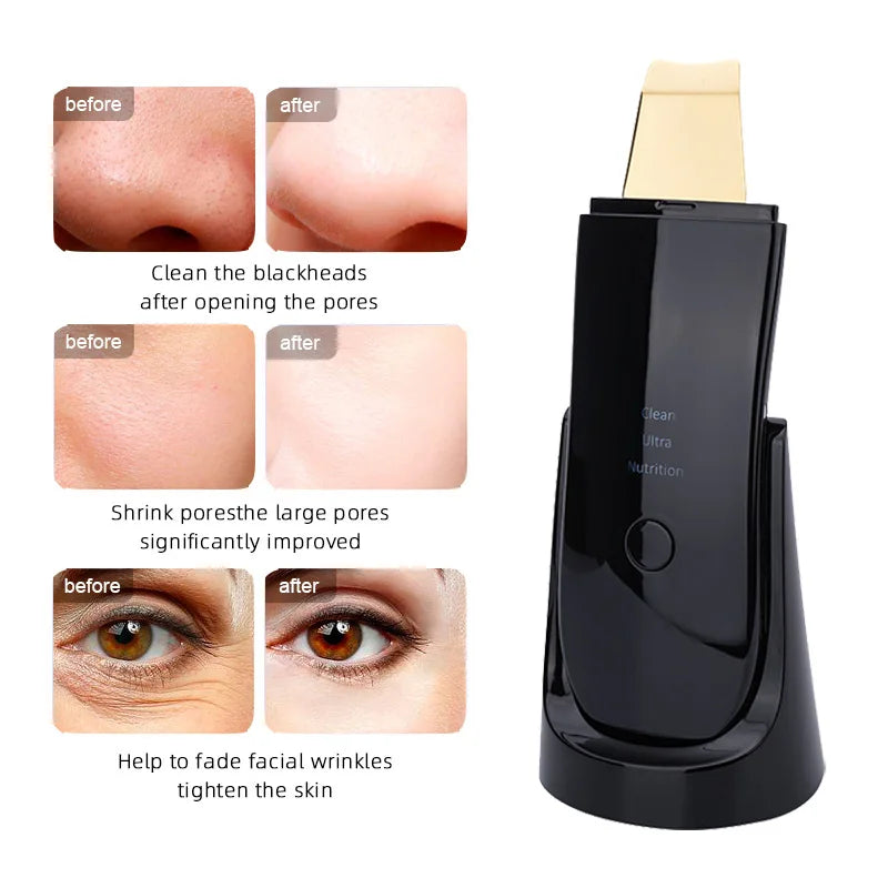 Lesen Ultrasonic Face Cleaner Skin Scrubber Ultrasound Vibration Lifting Massager Ultrasound Peeling Clean Tone Lift Scrubber DermaStorm