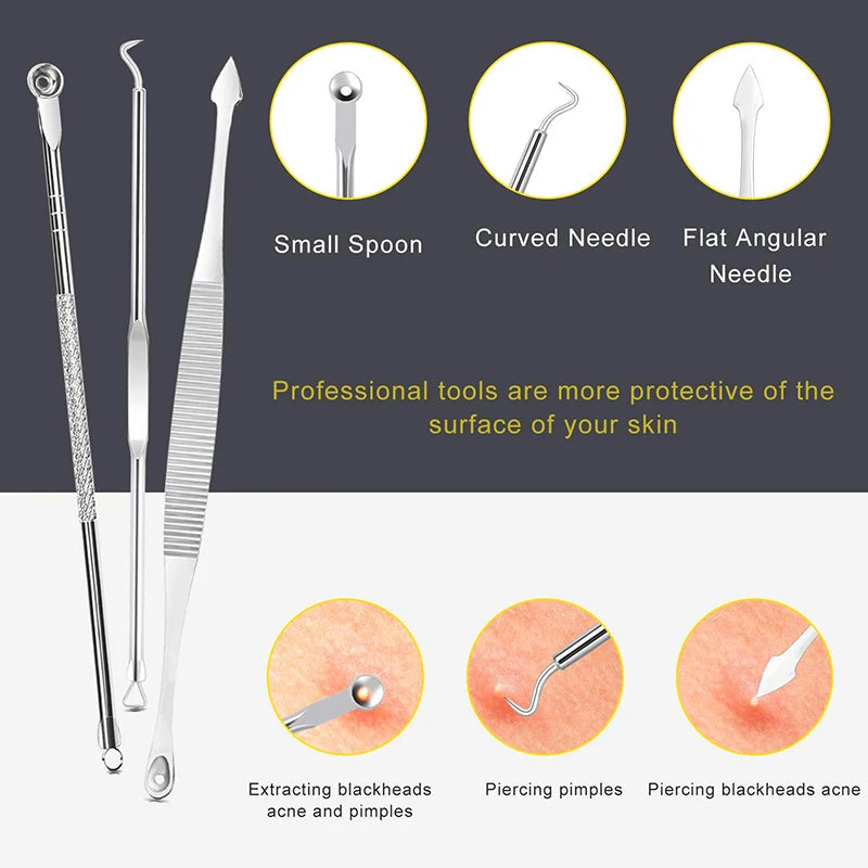 Professional 10‑Piece Blackhead & Pimple Extractor Kit DermaStorm