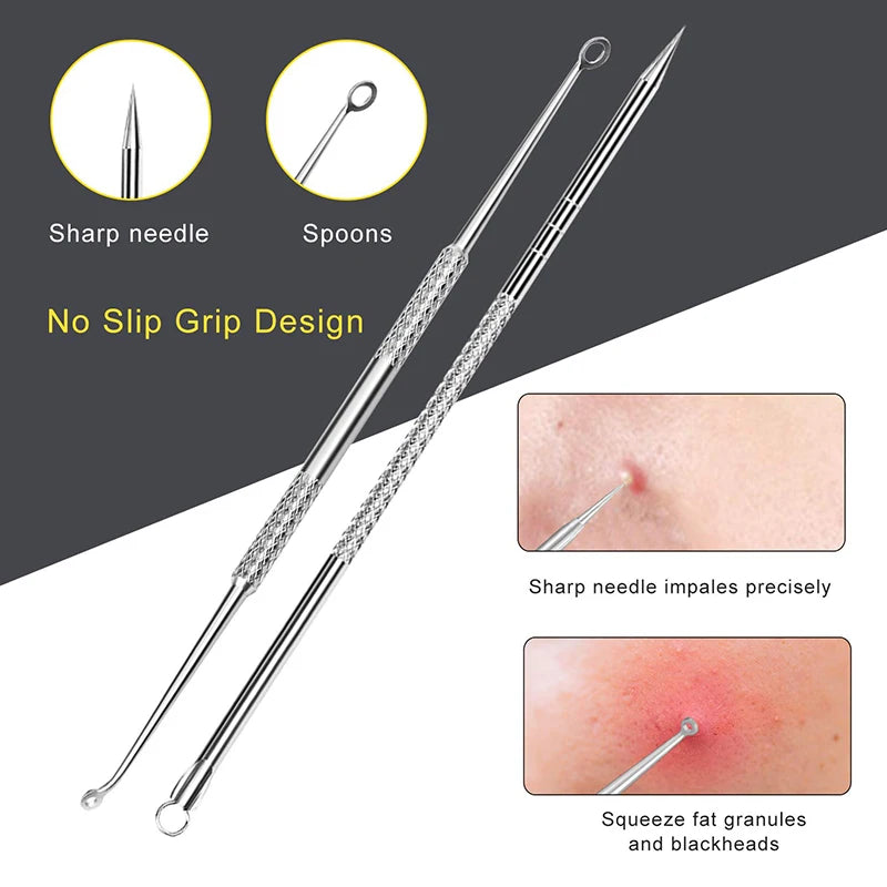 Professional 10‑Piece Blackhead & Pimple Extractor Kit DermaStorm