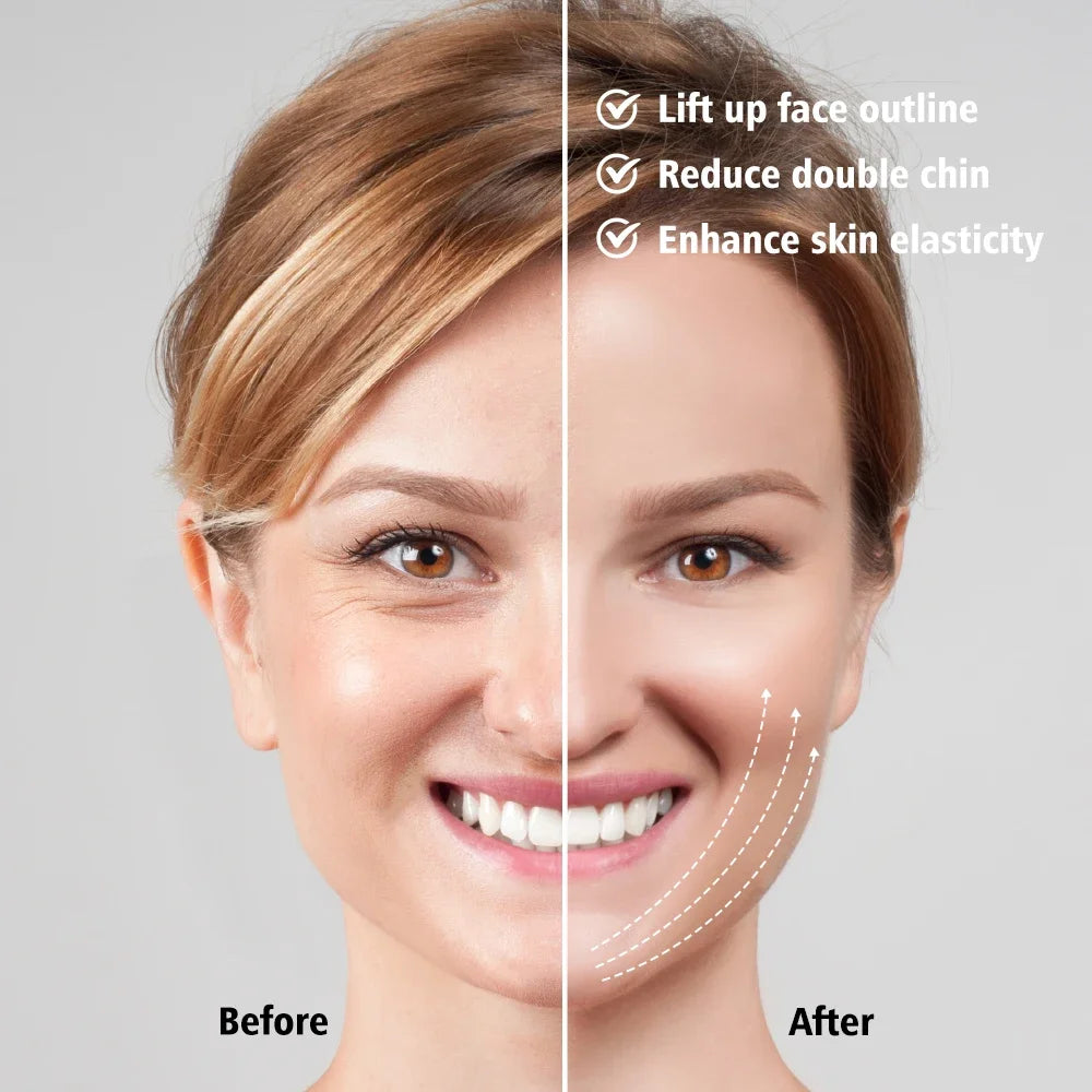 EMS Face Lifting Massager Anti Wrinkle Firming Facial Massager V-Face Lift Device Microcurrent Remover Double Chin Skin Care DermaStorm