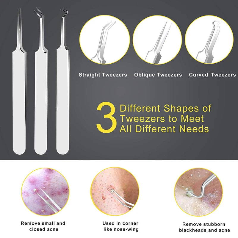 Professional 10‑Piece Blackhead & Pimple Extractor Kit DermaStorm