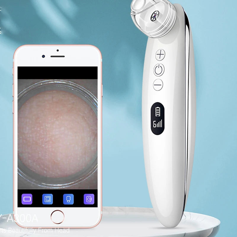 Visual Blackhead Vacuum Kit With Charging Base HD Camera 6-Level Skin Deep Cleaning Black Spots Strong Vacuum Suction DermaStorm