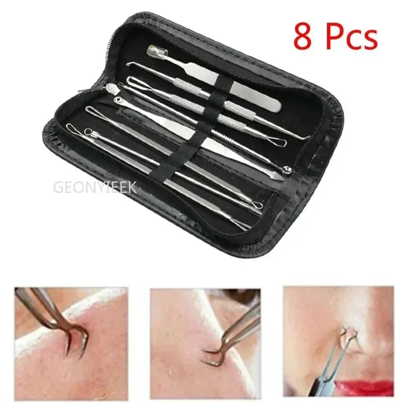 8pcs/set Blackhead Comedone Acne Pimple Blackhead Remover Tool Spoon for Face Skin Care Tool Needles Facial Pore Cleaner  FitiqueFit