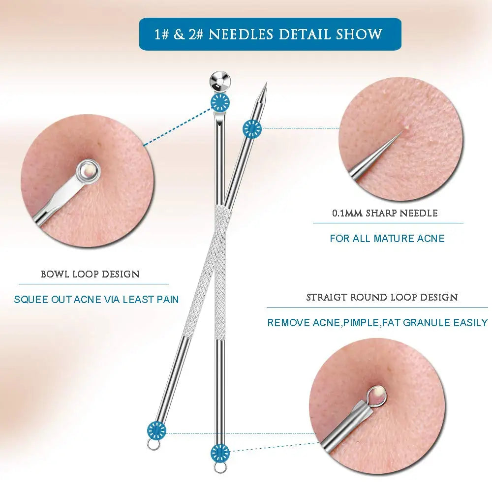 Dighealth 4PCS Stainless Steel Blackhead Remover Extraction Pimple Comedone Acne Extractor Whitehead Blemish Popper Kit  FitiqueFit