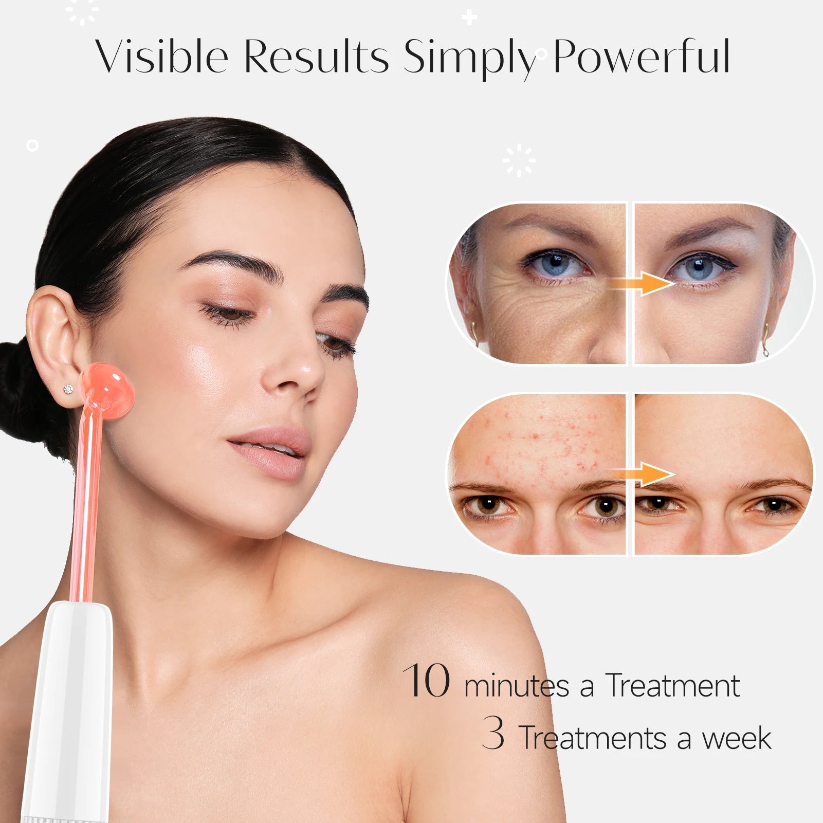 DARSONVAL High Frequency Electrode Wand Machine Neon Electrotherapy Glass Tube Acne Spot Wrinkles Remover Beauty Facial Care DermaStorm