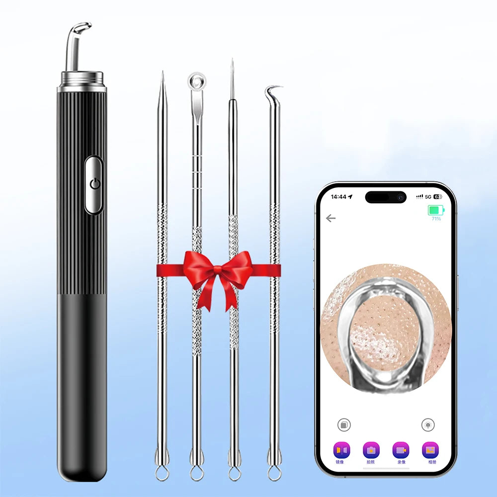 Visual Blackhead Remover with Camera Pimple Popper Extractor Tool Pore Cleaner Kit for Acne Comedone Whitehead Black Dots Remove  FitiqueFit