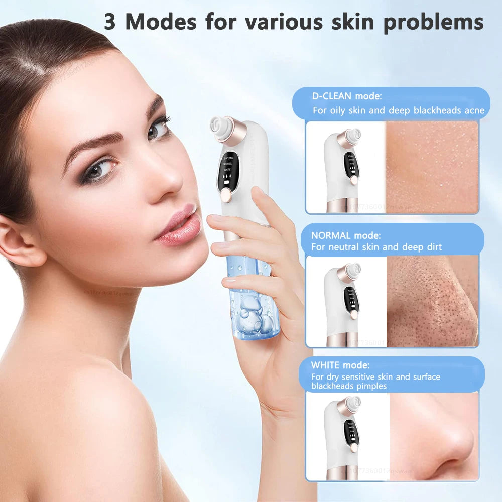 Blackhead Remover Pore Vacuum Face Cleaner Electric Pimple Acne Black Head Removal USB Rechargeable Water Cycle Black Dot Remove DermaStorm