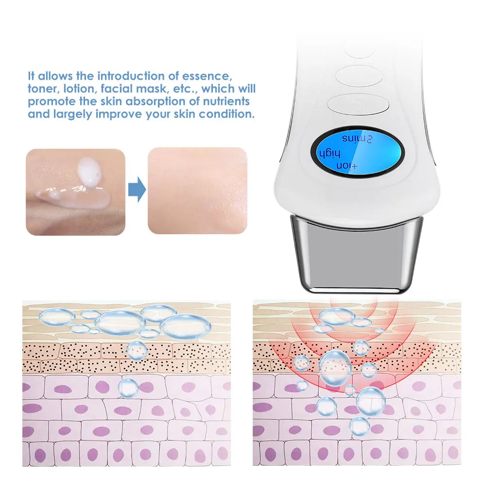 Handheld Galvanic SPA NU Electroporator DermaStorm