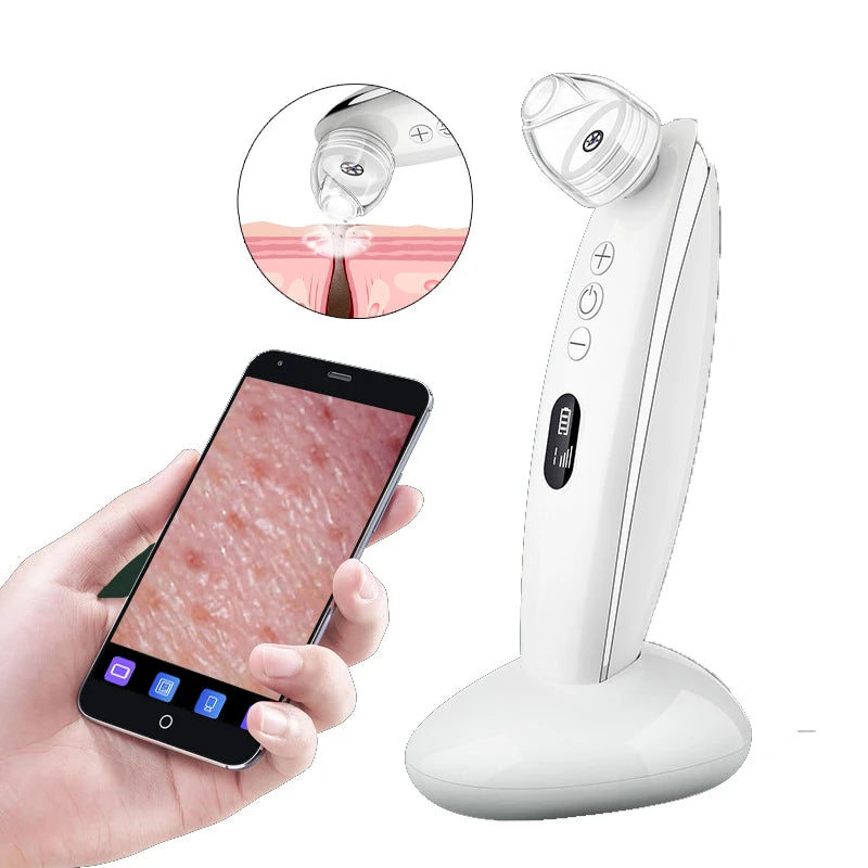 Visual Blackhead Vacuum Kit With Charging Base HD Camera 6-Level Skin Deep Cleaning Black Spots Strong Vacuum Suction DermaStorm
