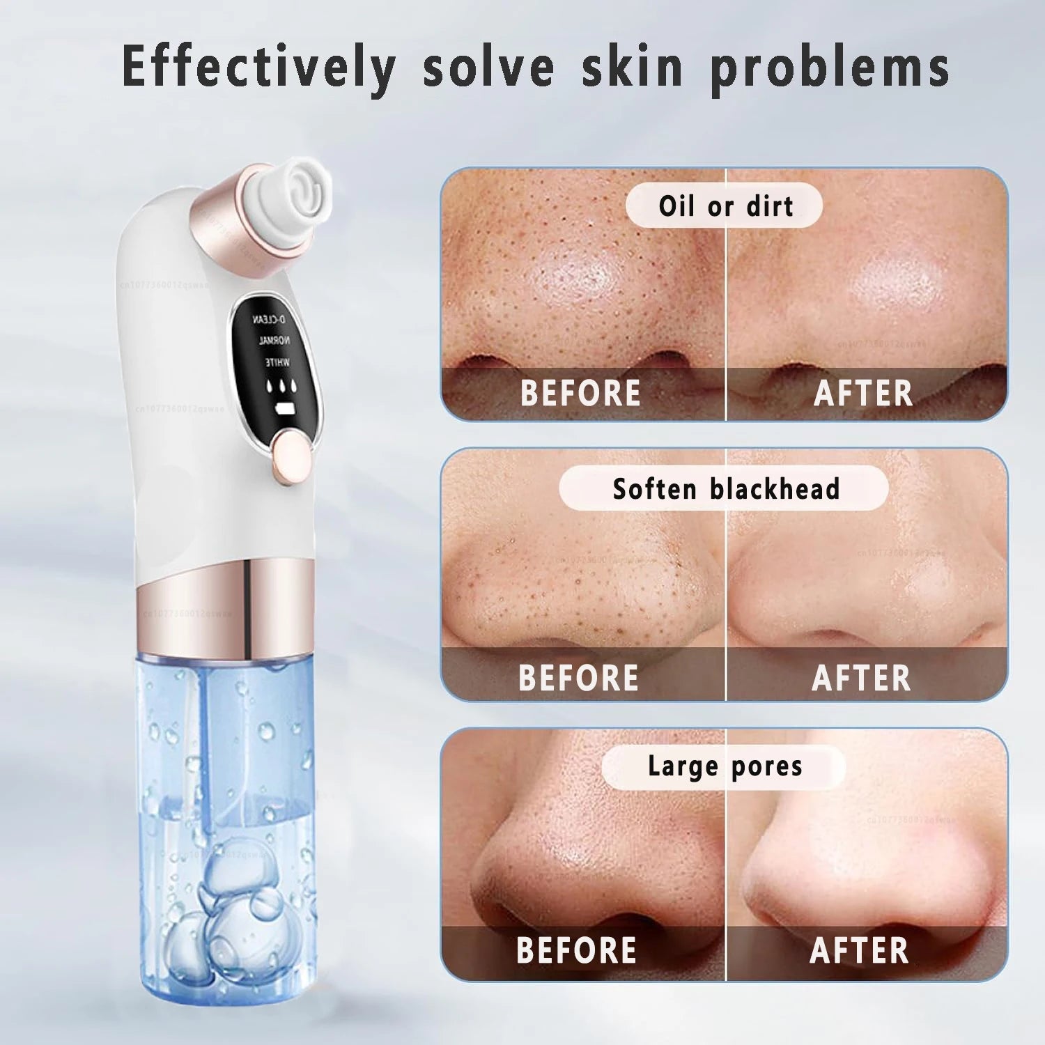 Blackhead Remover Pore Vacuum Face Cleaner Electric Pimple Acne Black Head Removal USB Rechargeable Water Cycle Black Dot Remove DermaStorm