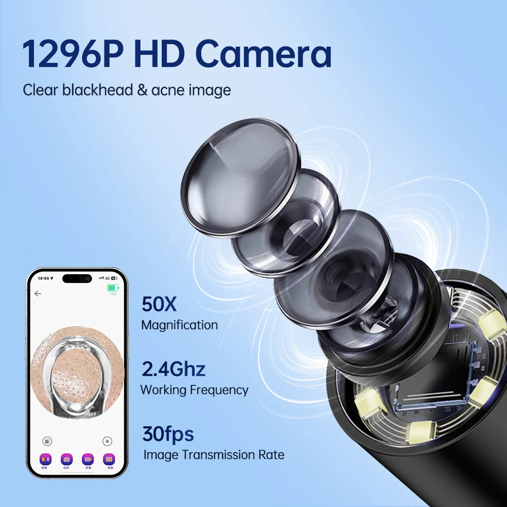 Visual Blackhead Remover with Camera Pimple Popper Extractor Tool Pore Cleaner Kit for Acne Comedone Whitehead Black Dots Remove  FitiqueFit