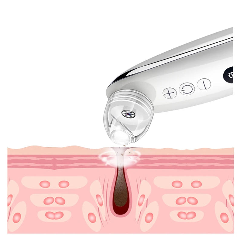 Visual Blackhead Vacuum Kit With Charging Base HD Camera 6-Level Skin Deep Cleaning Black Spots Strong Vacuum Suction DermaStorm
