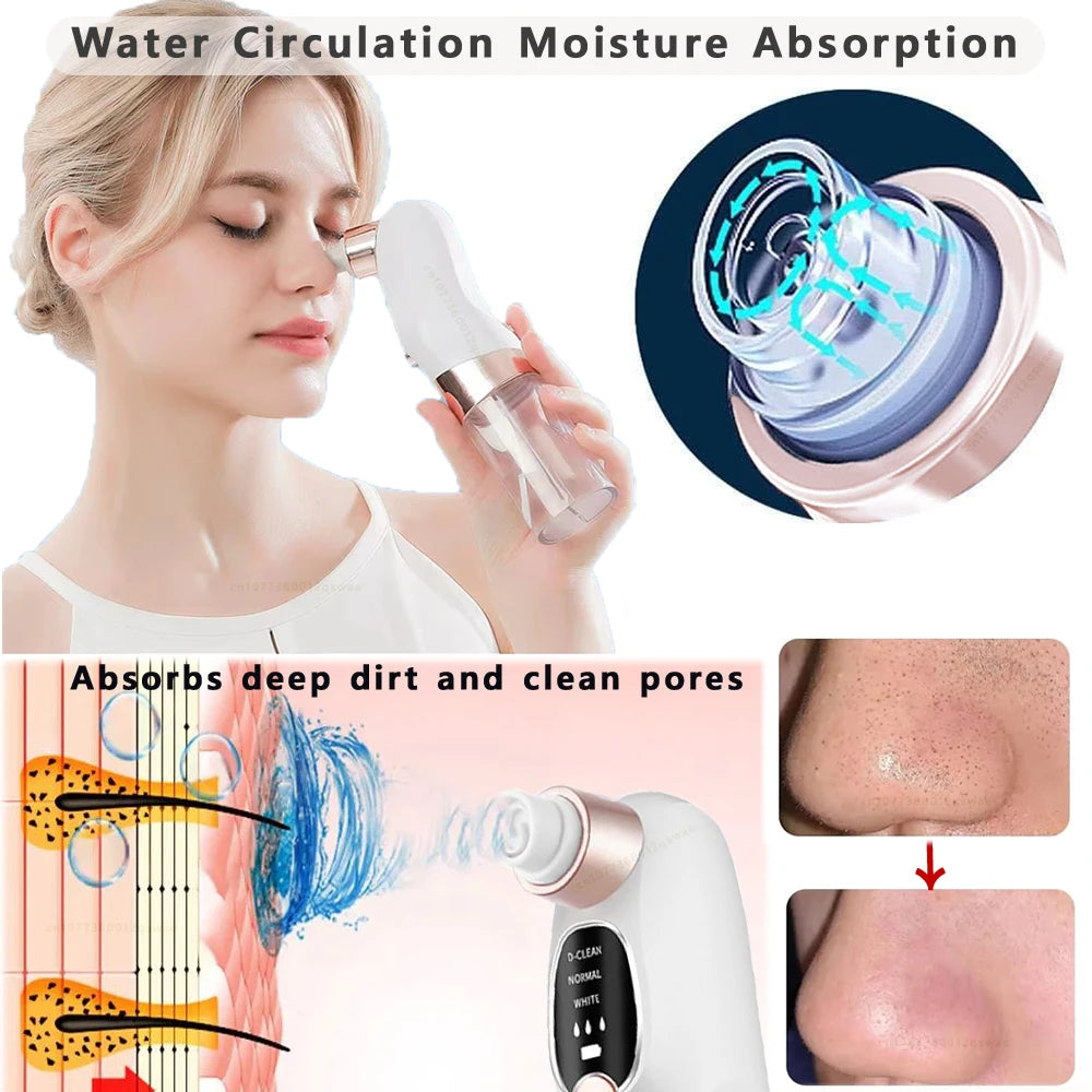 Blackhead Remover Pore Vacuum Face Cleaner Electric Pimple Acne Black Head Removal USB Rechargeable Water Cycle Black Dot Remove DermaStorm
