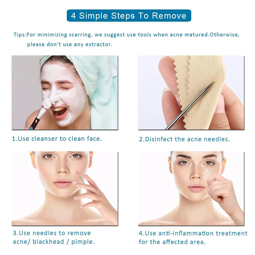 Dighealth 4PCS Stainless Steel Blackhead Remover Extraction Pimple Comedone Acne Extractor Whitehead Blemish Popper Kit  FitiqueFit