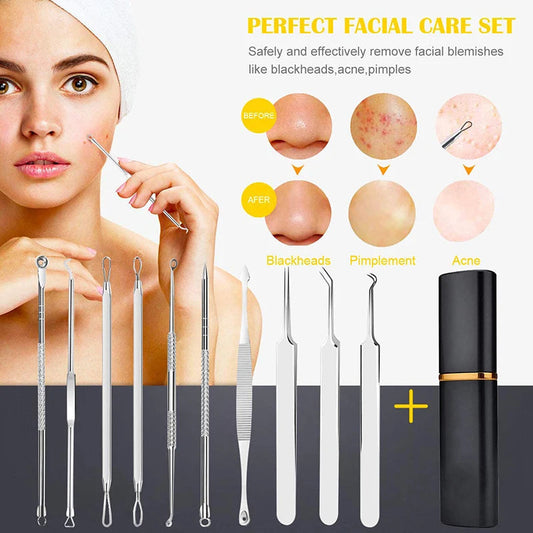 Professional 10‑Piece Blackhead & Pimple Extractor Kit  FitiqueFit