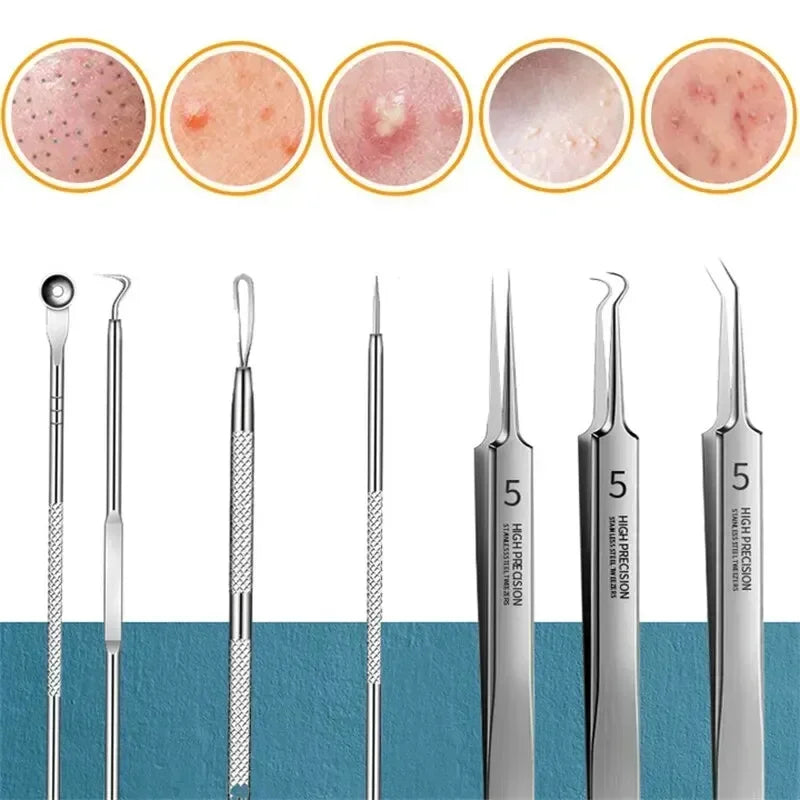 11‑Piece Ultra‑Fine Acne & Blackhead Tweezers Set DermaStorm