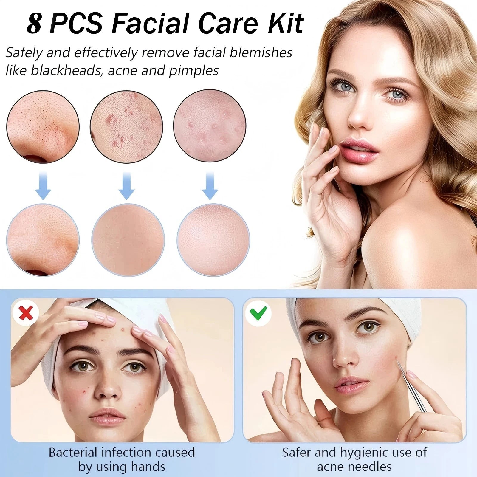 Stainless Steel Blackhead Removal Kit, Blemish and Acne Bottle Tool for All Skin Types, 8-Pack  FitiqueFit